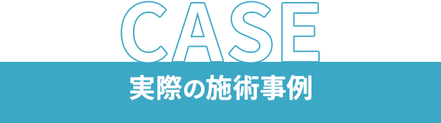実際の施術事例